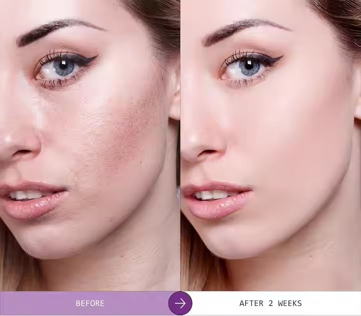 Organic Natural Skin Care Ghk-Cu Facial Whitening Collagen Anti Age 24K Gold Blue Copper Peptide Serum 12%（蓝铜肽精华液）