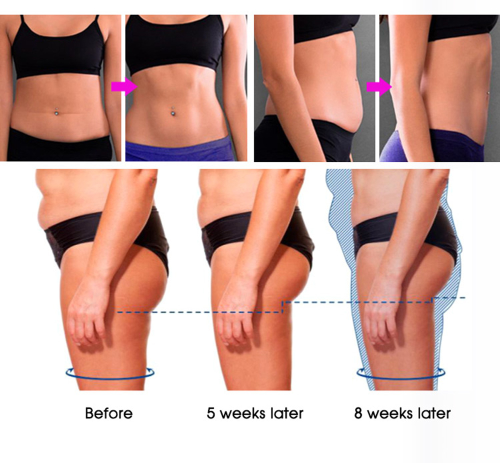 Upgraded RF EMSlim HI-EMT Advanced High Intense Focused Electromagnetic Body Slimming Sculpting Machine For Muscle Building