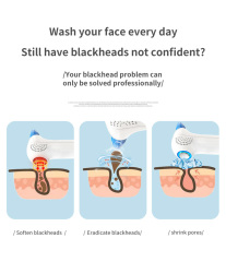 2021 New Home Use Rechargeable Hot And Cold Removal Acne Grease Facial Pore Cleaner Blackhead Skin Care Beauty Device
