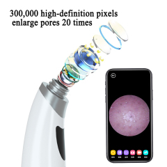 Amazon Hot Sale Visual Electric Blackhead Remover Blackhead Beauty Device