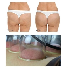 Multi-function Breast Enhancers Vacuum Buttock Lifting Machine Suction Cups Vacuum Lady Breast Nipple Enlargement