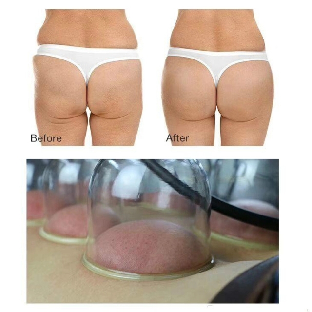 Multi-function Breast Enhancers Vacuum Buttock Lifting Machine Suction Cups Vacuum Lady Breast Nipple Enlargement