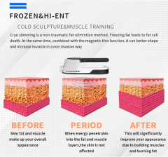 Wholesale Factory Price 2 In 1 Electromagnetic Muscle Stimulation With 360 Cyrolipolysis Cold Freezing Fat Loss HI-EMT Cooling Beauty Equipment