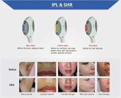 Wholesale Vertical IPL SHR Laser Hair Removal Epilator Beauty Machine