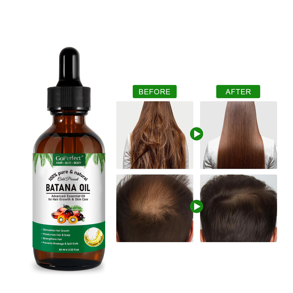 Cosmetics Supplier Hair Essential Oil - New Design Botana Oil - Hair Essential Oil for Home Use - Wholesale Hair Care Products,Wholesale Botana Oil for Hair Care, Premium Hair Oil Solutions,Guangdong Mingli Biomedical Technology Co., Ltd.