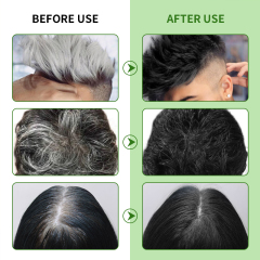 Ammonia-Free & Scalp-Stain-Free Bubble Mousse Hair Dye Shampoo: The Ultimate White & Gray Hair Repair for Hair Health,Herbal Bubble Hair Color | Ammonia-Free Foam Dye for Middle East,Guangdong Mingli Biomedical Technology Co., Ltd.
