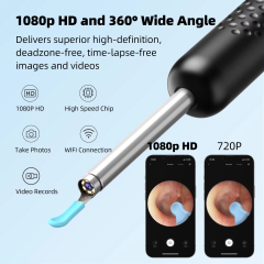 Bebird R1 Health Care AI Recognition of External EarCanal Ear Cleaners with Cameras