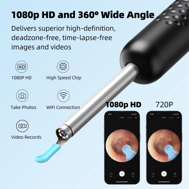 Bebird R1 Health Care AI Recognition of External EarCanal Ear Cleaners with Cameras