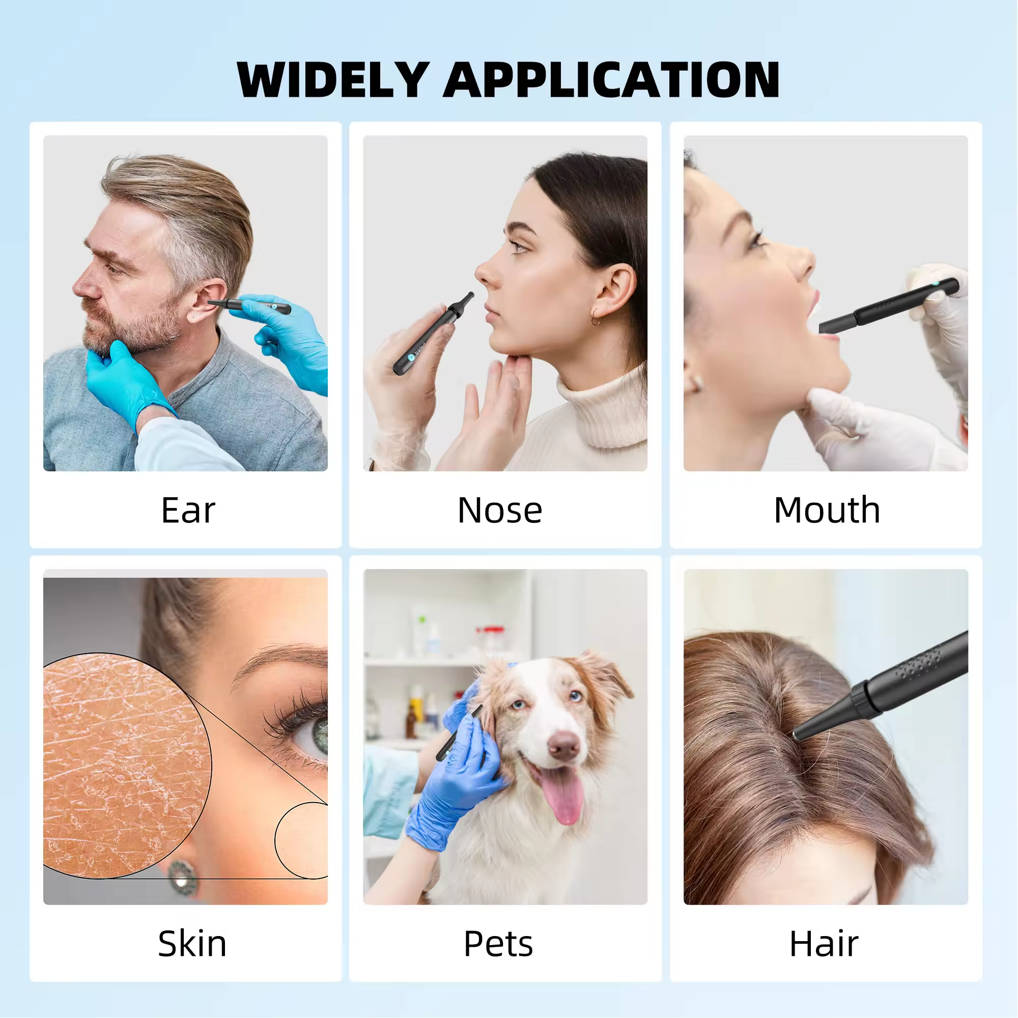 Bebird R1 Health Care AI Recognition of External EarCanal Ear Cleaners with Cameras