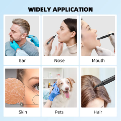Bebird R1 Health Care AI Recognition of External EarCanal Ear Cleaners with Cameras