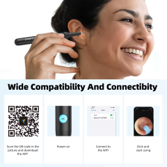 Bebird R1 Health Care AI Recognition of External EarCanal Ear Cleaners with Cameras
