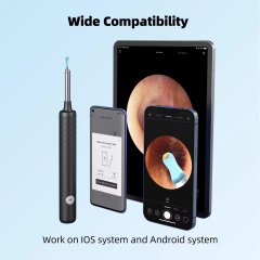 Bebird R1 Health Care AI Recognition of External EarCanal Ear Cleaners with Cameras