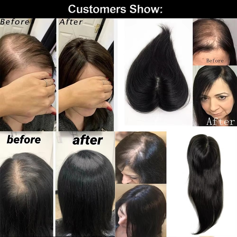 5x8cm Human Hair Women Toppers Natural 2 Clips Silky Straight Human Hair Topper Piece