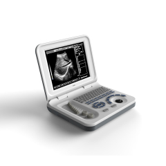 FTL-UTS60 Cheap Digital Handheld Laptop scaner Portable Ultrasound Machine,Fatali Medical equipment