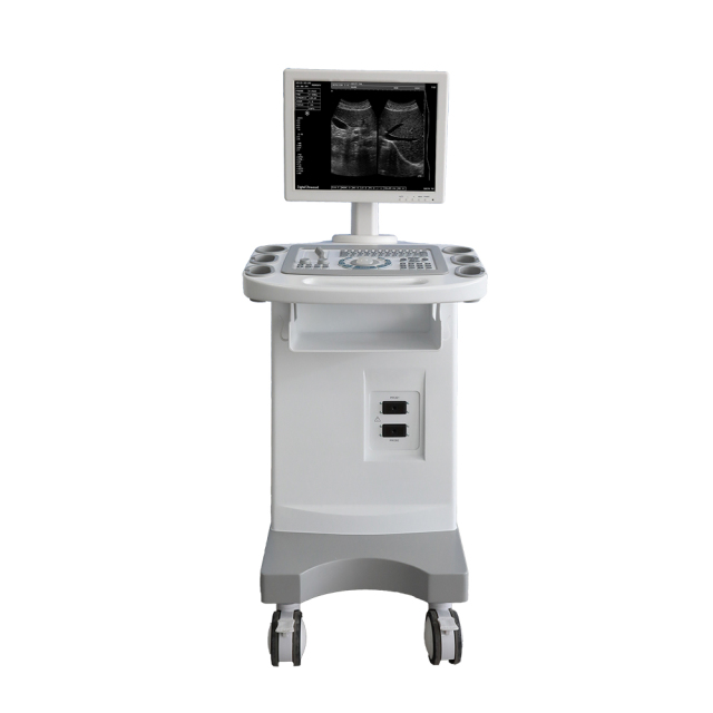 FTL-UTS80 Trolley B/W Ultrasound Cheap Full Digital Diagnostic price 15" HD display,Fatali Medical equipment