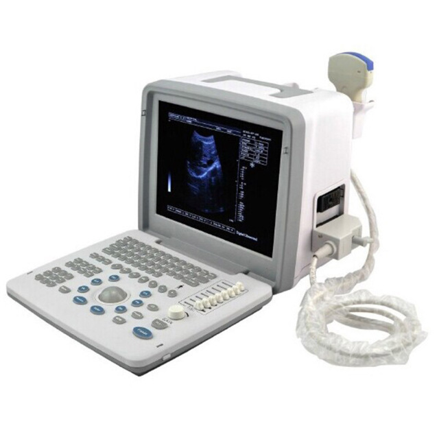 Portable 2D Ultrasound Diagnostic Urgent Care Ultrasound​ Machine,Fatali Medical equipment