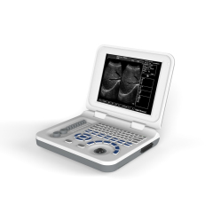 FTL-UTS60 Cheap Digital Handheld Laptop scaner Portable Ultrasound Machine,Fatali Medical equipment
