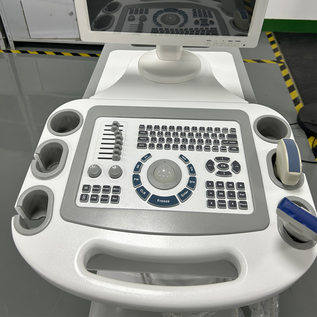 FTL-UTS80 Trolley B/W Ultrasound Cheap Full Digital Diagnostic price 15" HD display,Fatali Medical equipment