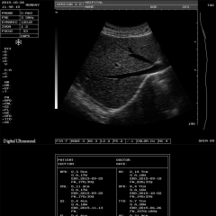 FTL-UTS60 Cheap Digital Handheld Laptop scaner Portable Ultrasound Machine,Fatali Medical equipment