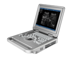 FTL-UTS20 Notebook B/W Ultrasound machine 3D 4D Color Doppler factory price,Fatali Medical equipment