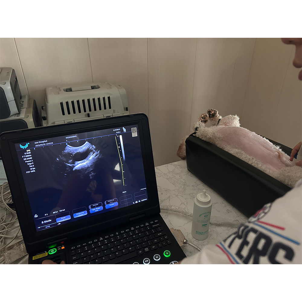 Portable 4D Color Doppler Ultrasound Therapy Machine
