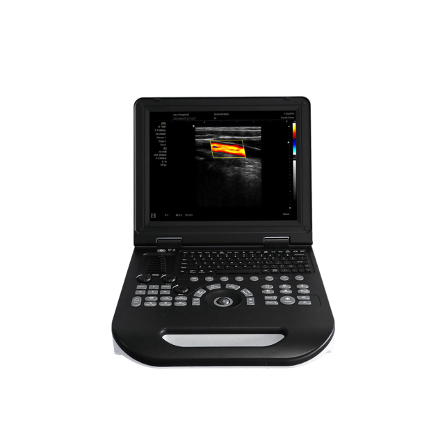FTL-UTS100 Hot Medical Ultrasound Instrument 3D 4D Portable Sonoscape,Fatali Medical equipment