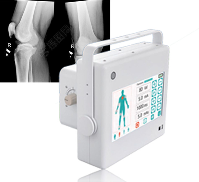 FTLF10 1KW Portable X ray Machine price Small Size X-rays,Fatali Medical equipment