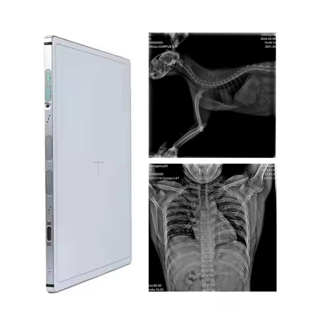 FTL-4343A  wired Flat Panel Detector for Human or Veterinary Use,Fatali Medical equipment