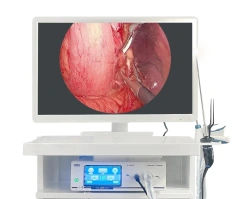 Portable Reusable HD Endoscope for Human Use for ENT Joints Inspection of Abdomen and Thoracic Cavity Cystoscope,Fatali Medical equipment