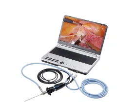 Portable Reusable 4K Endoscope for ENT Abdomen and Thoracic Cavity Inspections,Fatali Medical equipment