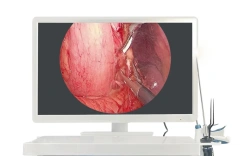 Portable Reusable HD Endoscope for Human Use for ENT Joints Inspection of Abdomen and Thoracic Cavity Cystoscope,Fatali Medical equipment