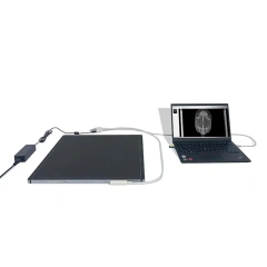 Portable Wired Flat Panel Detector X-ray Detector Diagnosis Machine,Fatali Medical equipment