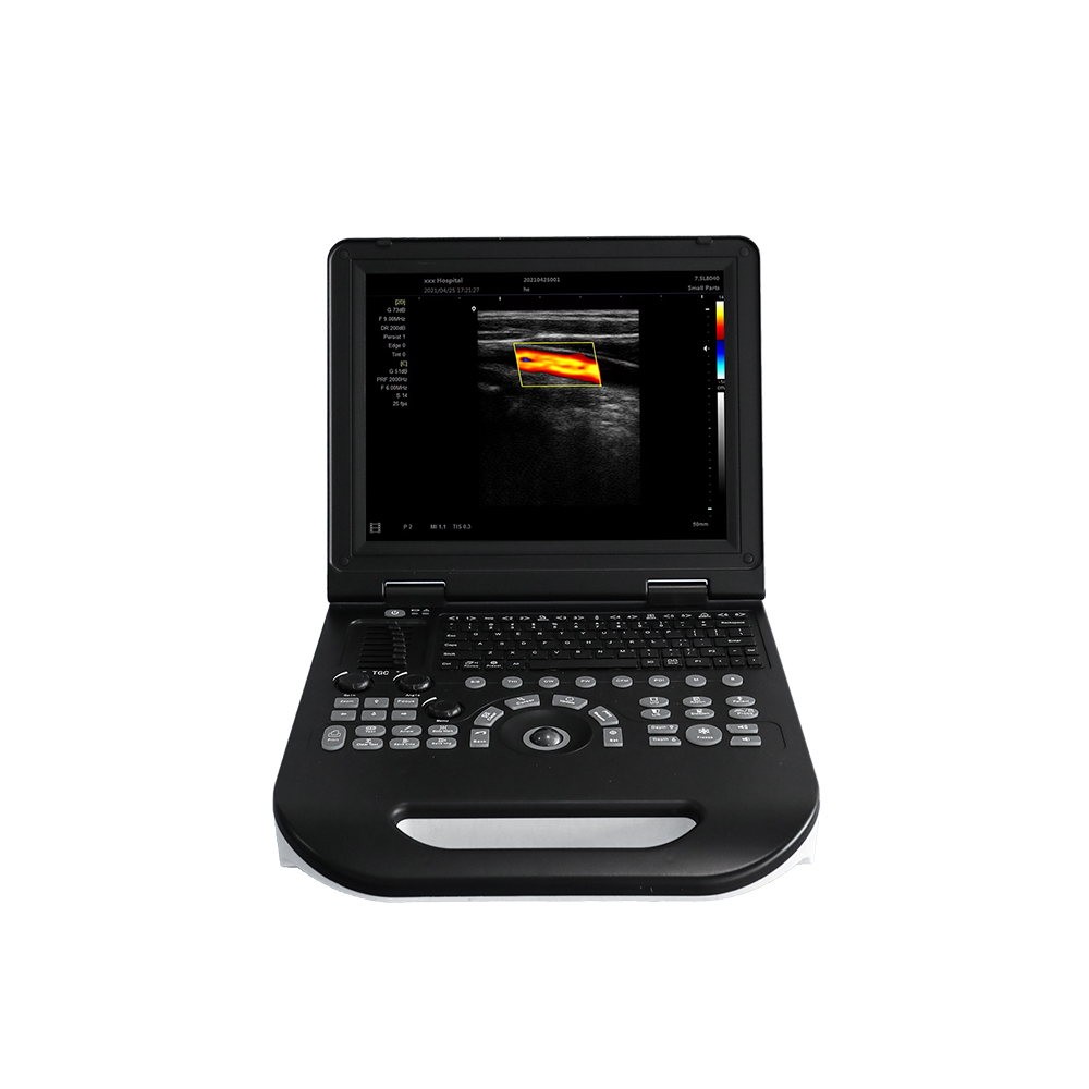 ultrasound