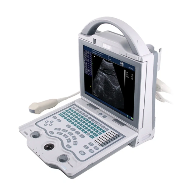 4d Ultrasonic Medical Echo Machine Portable Doppler Ultrasound ICU Diagnostic Ultrasound Machine,Fatali Medical equipment