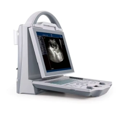 4d Ultrasonic Medical Echo Machine Portable Doppler Ultrasound ICU Diagnostic Ultrasound Machine,Fatali Medical equipment