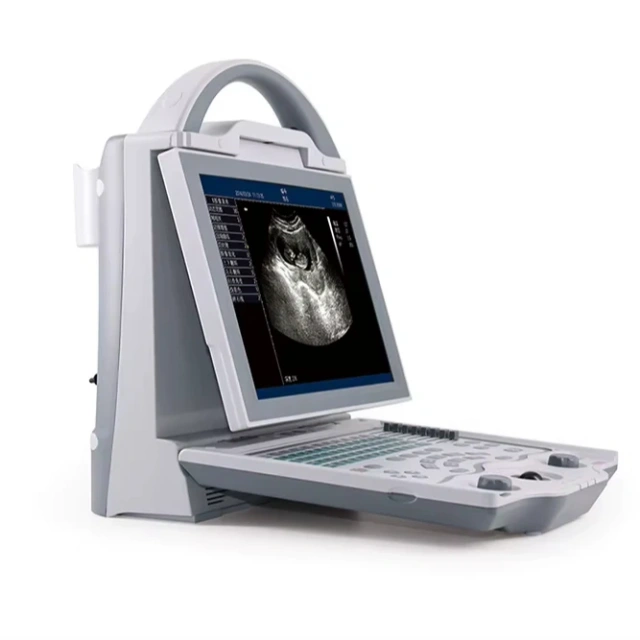 4d Ultrasonic Medical Echo Machine Portable Doppler Ultrasound ICU Diagnostic Ultrasound Machine,Fatali Medical equipment