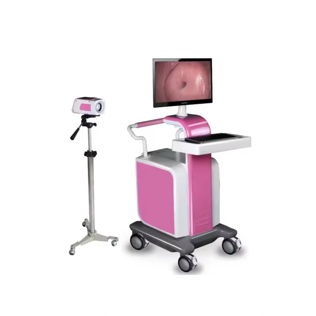 Medical HD Digital Video Colposcope Camera Gynecology Colposcope Portable Trolley-type,Fatali Medical equipment