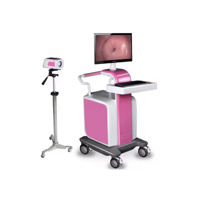 Medical HD Digital Video Colposcope Camera Gynecology Colposcope Portable Trolley-type,Fatali Medical equipment