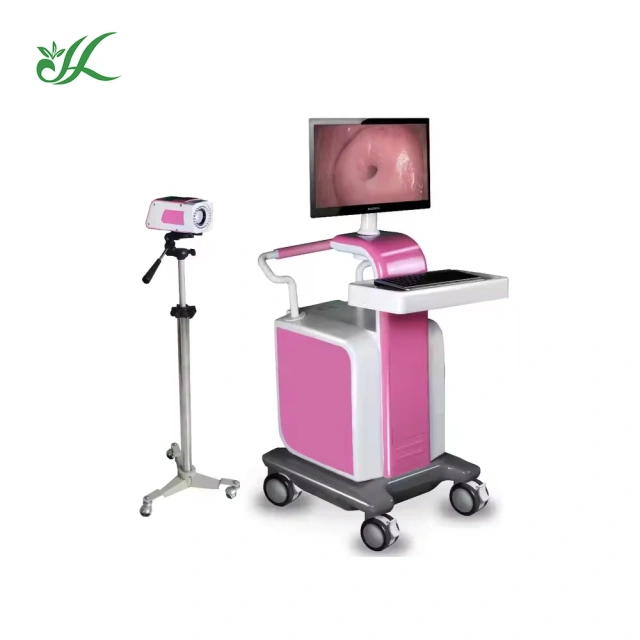 Medical HD Digital Video Colposcope Camera Gynecology Colposcope Portable Trolley-type,Fatali Medical equipment