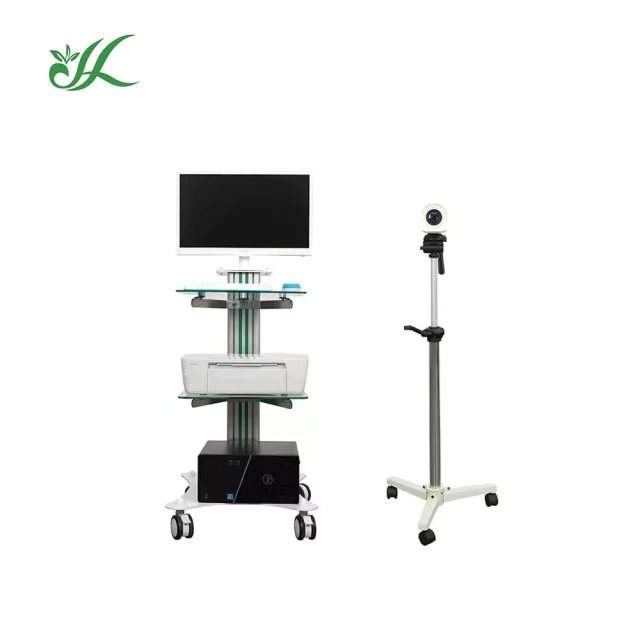 Medical HD Digital Video Colposcope Camera Gynecology Colposcope Portable Trolley-type,Fatali Medical equipment