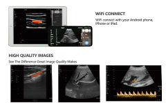Pocket Ultrasound Machine Price Portable Wireless Ultrasound Double Probe with Wifi,Fatali Medical equipment