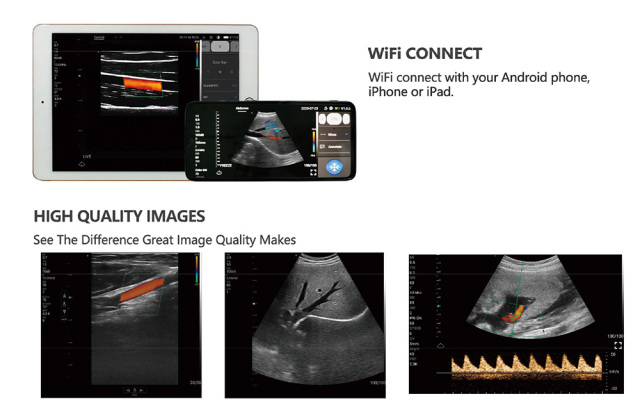 Pocket Ultrasound Machine Price Portable Wireless Ultrasound Double Probe with Wifi,Fatali Medical equipment