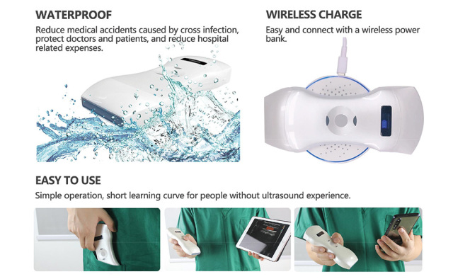 Wireless Wifi Ultrasound Probe Handheld Ultrasound Device Mobile Diagnostic Imaging Solutions,Fatali Medical equipment