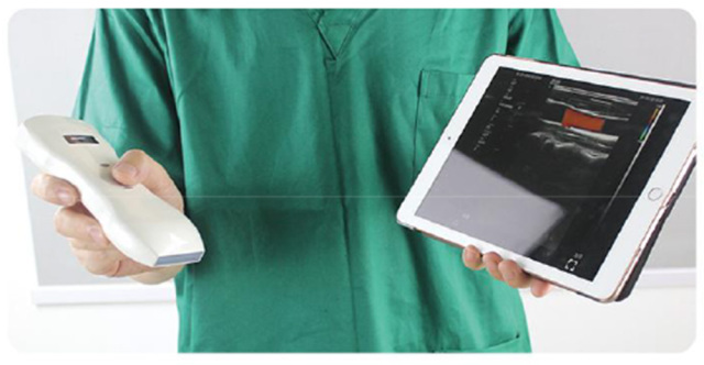 Pocket Ultrasound Machine Price Portable Wireless Ultrasound Double Probe with Wifi,Fatali Medical equipment