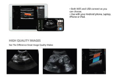 Wireless Wifi Handheld Veterinary Ultrasound Probe,Fatali Medical equipment
