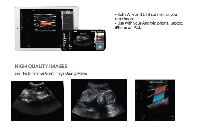 Wireless Wifi Handheld Veterinary Ultrasound Probe,Fatali Medical equipment