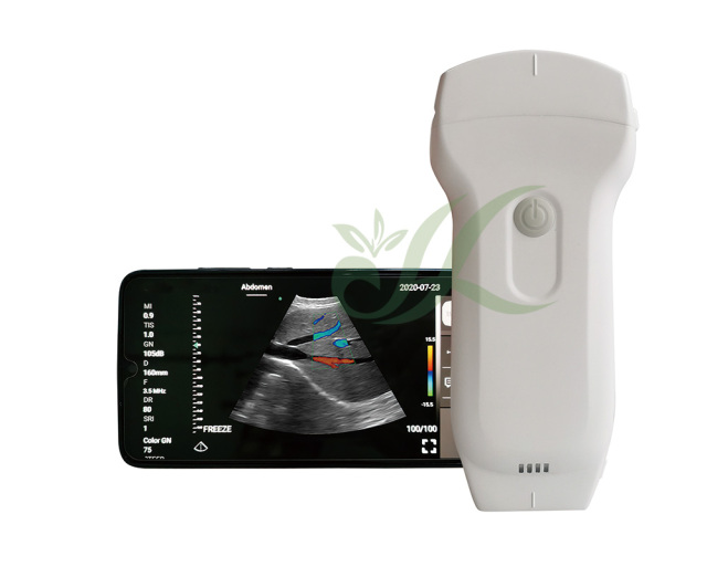 Wireless Wifi Handheld Veterinary Ultrasound Probe,Fatali Medical equipment