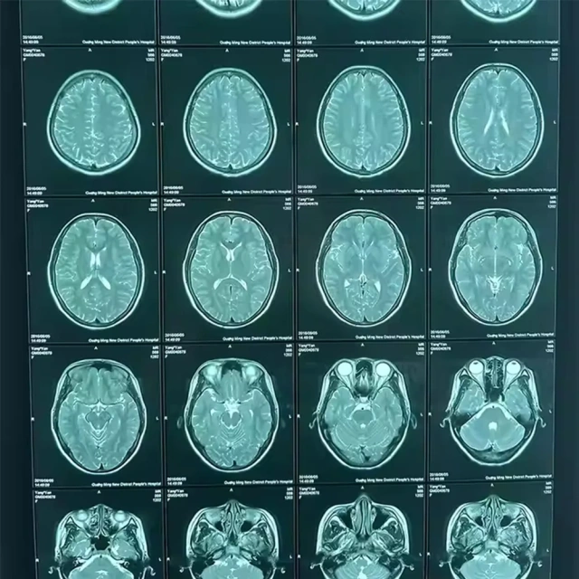 Medical Thermal Film X-ray Film Replaces Film,Fatali Medical equipment