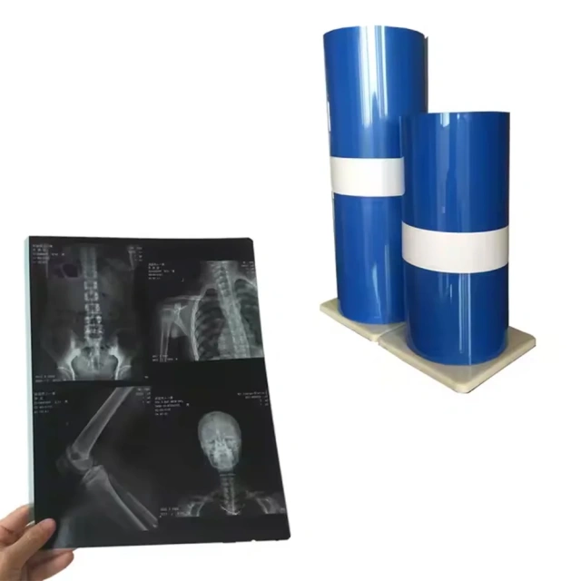 Medical Thermal Film X-ray Film Replaces Film,Fatali Medical equipment