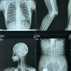 Medical Thermal Film X-ray Film Replaces Film,Fatali Medical equipment